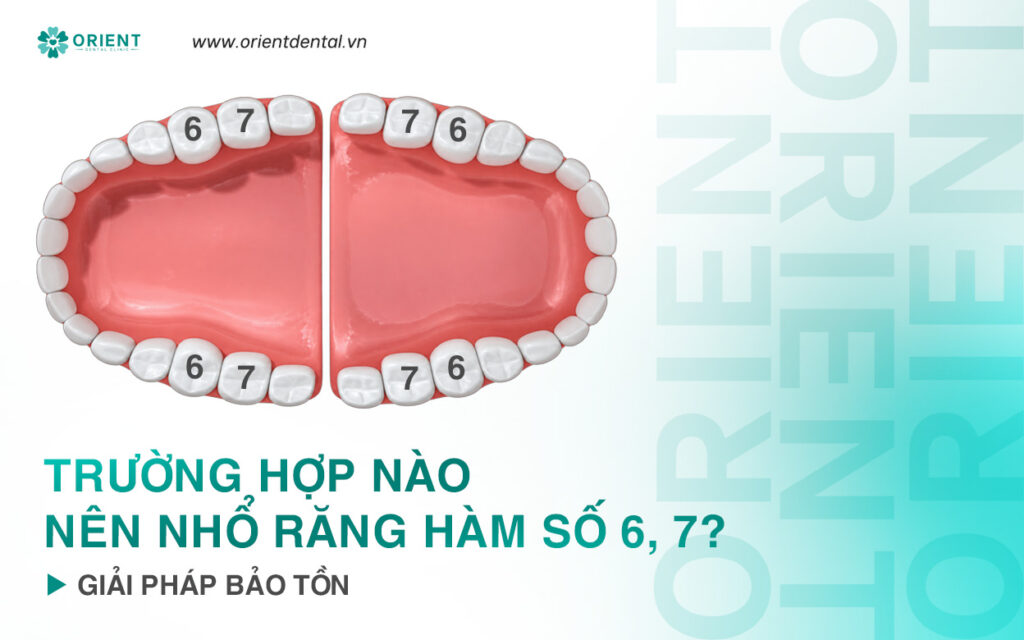 Truong hop nao nen nho rang so 67