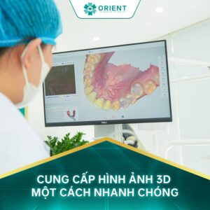 Chọn Implant Không Chỉ Nhìn Vào Giá 5 Yếu Tố Cần Quan Tâm