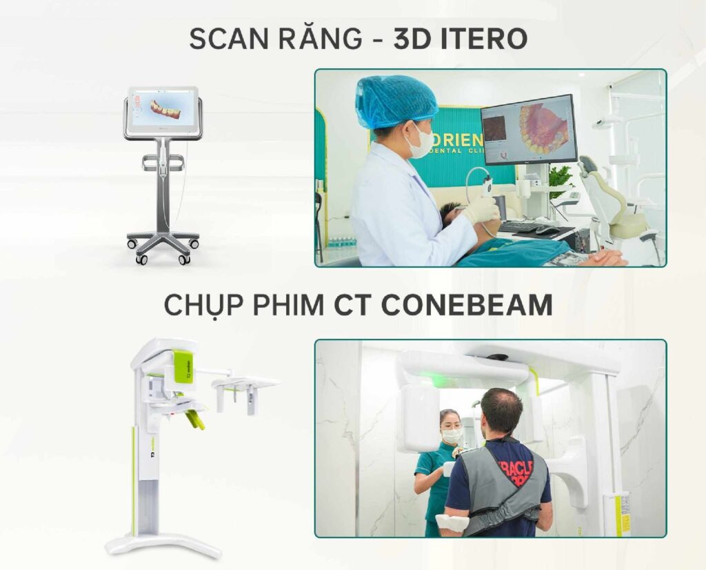 Răng Sứ Không Tự Nhiên: 3 Yếu Tố Quyết Định Thẩm Mỹ